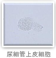 検査科HP(一般検査-尿沈渣-画像4).jpg