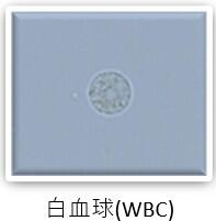 検査科HP(一般検査-尿沈渣-画像2).jpg