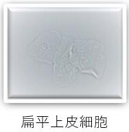 検査科HP(一般検査-尿沈渣-画像3).jpg