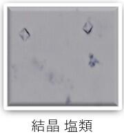 検査科HP(一般検査-尿沈渣-画像7).jpg