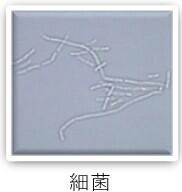 検査科HP(一般検査-尿沈渣-画像6).jpg