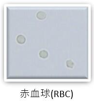 検査科HP(一般検査-尿沈渣-画像1).jpg