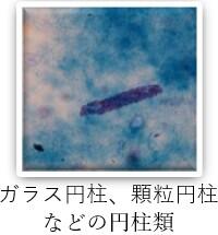 検査科HP(一般検査-尿沈渣-画像5).jpg